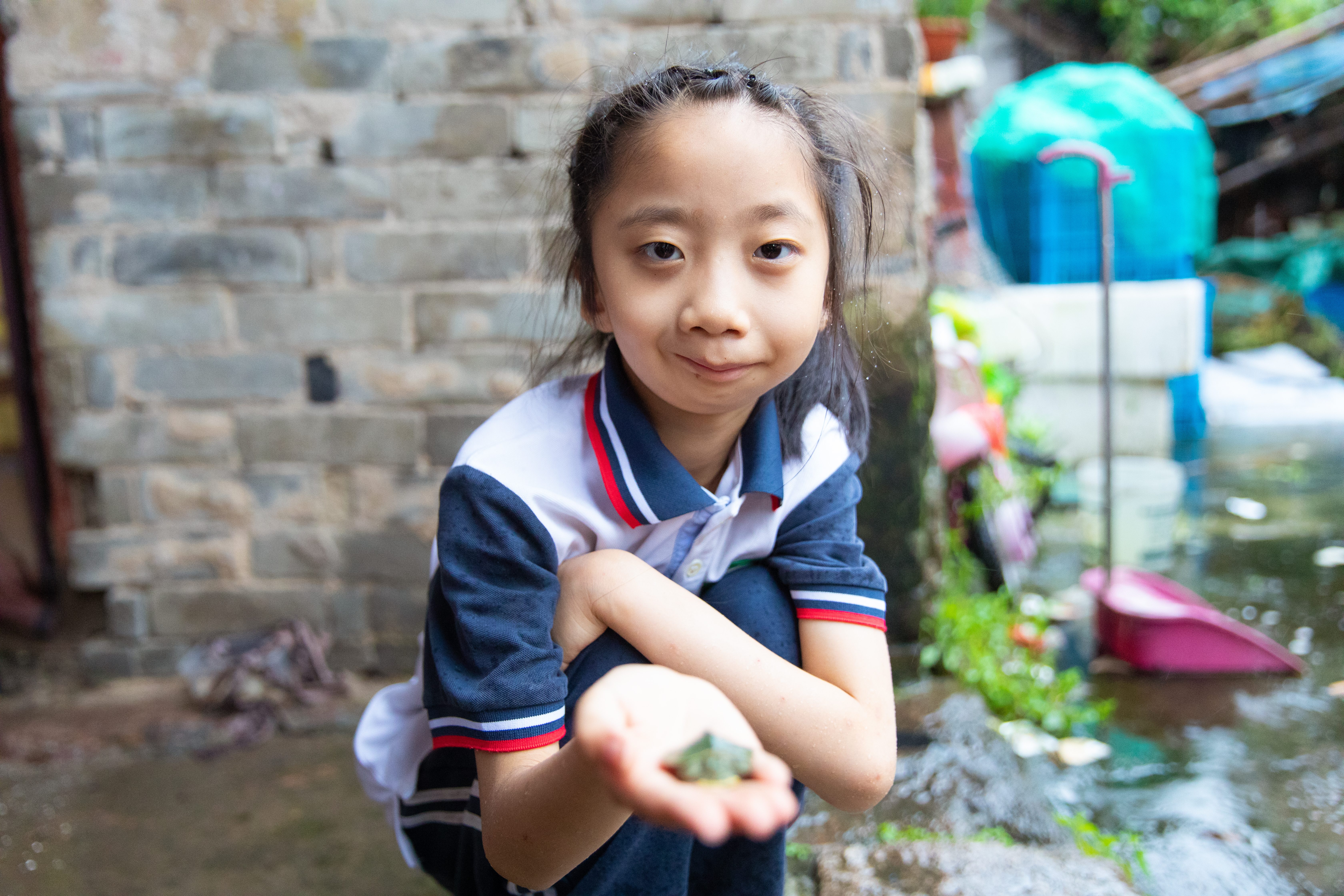 八年間三次手術 先天性“無嘴”小孩的重建人生